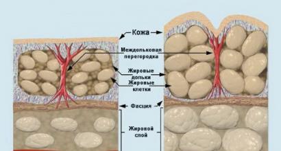 Πώς να κάνετε μασάζ κατά της κυτταρίτιδας